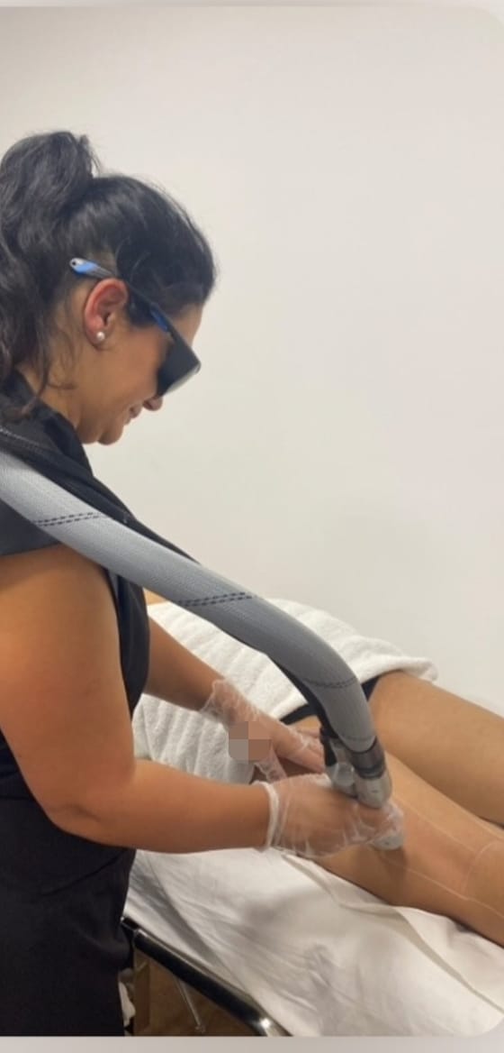 Detalhe de tratamento profissional de depilação a laser