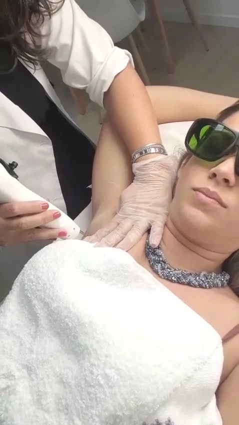 Demonstração em vídeo de depilação a laser por Graziela Moniz